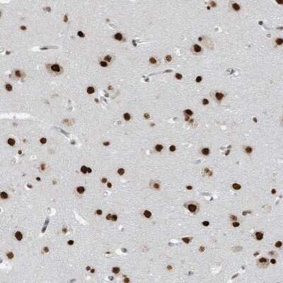 Immunohistochemistry-Paraffin: KHSRP Antibody [NBP1-84719]