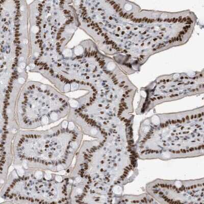 Immunohistochemistry-Paraffin: KHSRP Antibody [NBP1-84719]