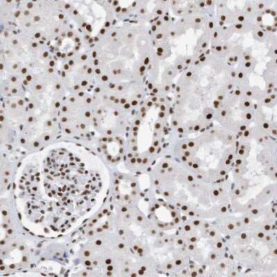 Immunohistochemistry-Paraffin: KHSRP Antibody [NBP1-84719]