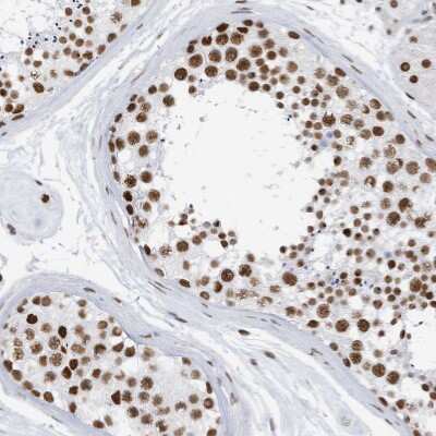 Immunohistochemistry-Paraffin: KHSRP Antibody [NBP1-84719]