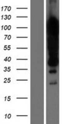 Western Blot: KHSRP Overexpression Lysate [NBP2-07966]