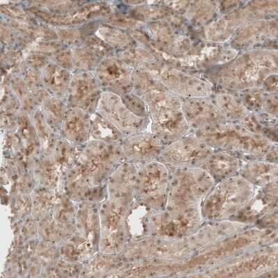 Immunohistochemistry-Paraffin: PUM3 Antibody [NBP1-87296]