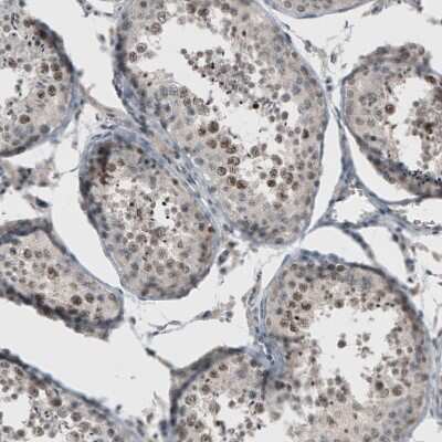 Immunohistochemistry-Paraffin: PUM3 Antibody [NBP1-87296]