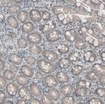 Immunohistochemistry-Paraffin: PUM3 Antibody [NBP1-87296]