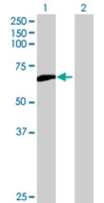 Western Blot: PUM3 Antibody [H00009933-B01]