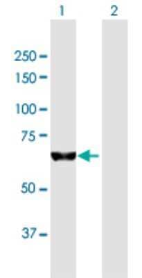 Western Blot: PUM3 Antibody [H00009933-B01]