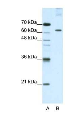 Western Blot: PUM3 Antibody [NBP1-57531]