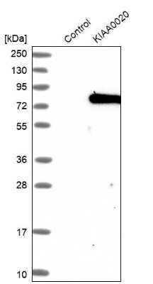 Western Blot: PUM3 Antibody [NBP1-87296]