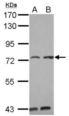 Western Blot: PUM3 Antibody [NBP2-17042]