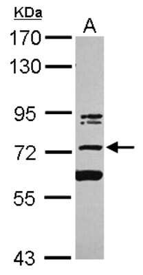 Western Blot: PUM3 Antibody [NBP2-17043]