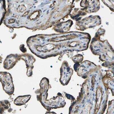 Immunohistochemistry: KIAA0040 Antibody [NBP2-59798]