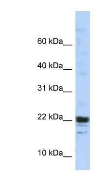 Western Blot: KIAA0040 Antibody [NBP1-91623]