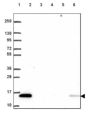 Western Blot: KIAA0040 Antibody [NBP2-49573]