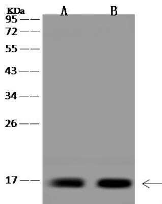 Western Blot: KIAA0040 Antibody [NBP3-12664]