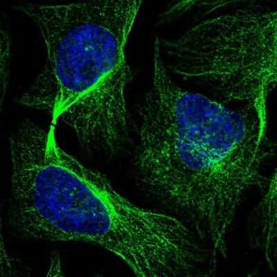 Immunocytochemistry/ Immunofluorescence: EMC1 Antibody [NBP2-14151]