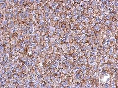Immunohistochemistry-Paraffin: EMC1 Antibody [NBP2-17044]