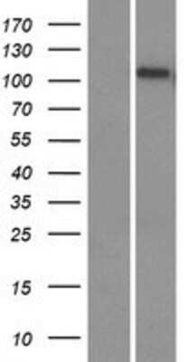 Western Blot: EMC1 Overexpression Lysate [NBP2-07228]