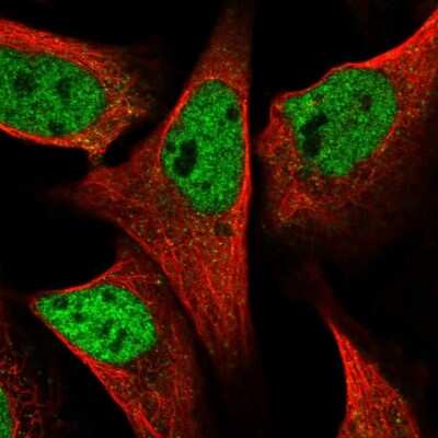 Immunocytochemistry/ Immunofluorescence: SPIDR Antibody [NBP2-58967]