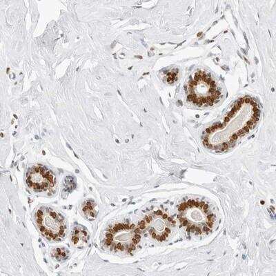 Immunohistochemistry-Paraffin: SPIDR Antibody [NBP1-91044]