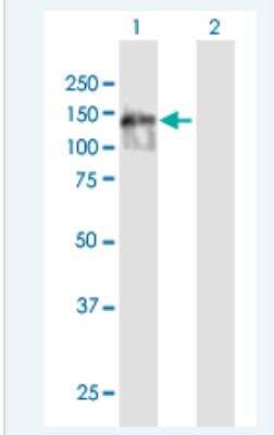 Western Blot: SPIDR Antibody [H00023514-B01P-50ug]