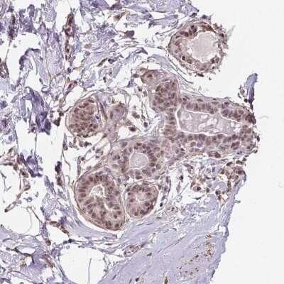 Immunohistochemistry: KIAA0232 Antibody [NBP2-49339]