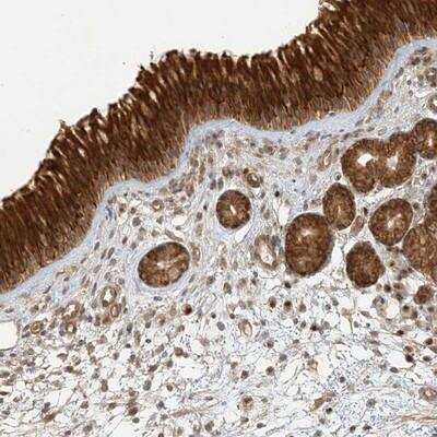 Immunohistochemistry-Paraffin: KIAA0232 Antibody [NBP1-86281]