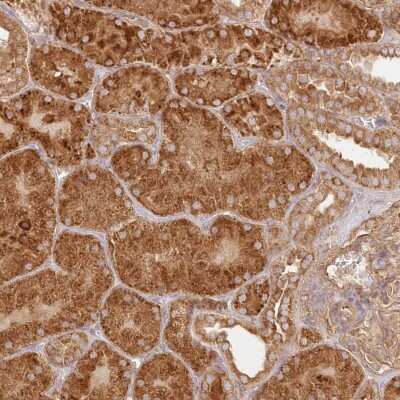 Immunohistochemistry-Paraffin: KIAA0232 Antibody [NBP2-48668]