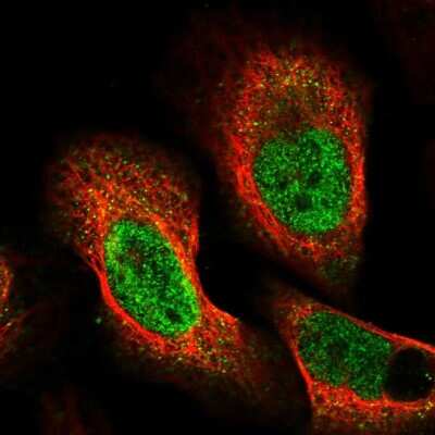 Immunocytochemistry/ Immunofluorescence: BICRAL Antibody [NBP1-86359]