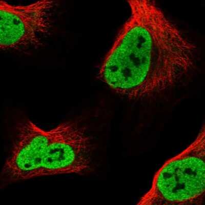 Immunocytochemistry/ Immunofluorescence: BICRAL Antibody [NBP1-86360]