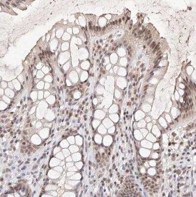 Immunohistochemistry-Paraffin: BICRAL Antibody [NBP1-86359]