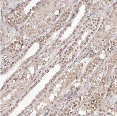 Immunohistochemistry-Paraffin: BICRAL Antibody [NBP1-86359]