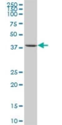 Western Blot: SUSD6 Antibody [H00009766-B01P]