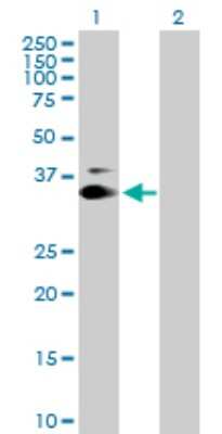 Western Blot: SUSD6 Antibody [H00009766-B01P]