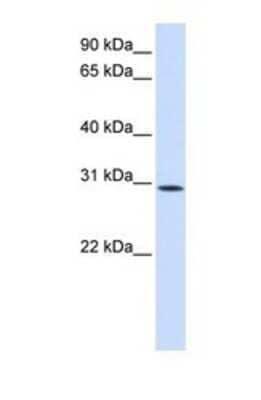 Western Blot: SUSD6 Antibody [NBP1-69581]