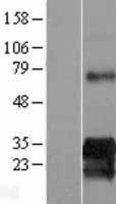 Western Blot: SUSD6 Overexpression Lysate [NBL1-12240]