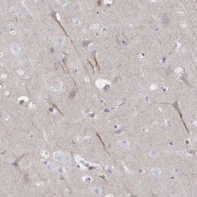 Immunohistochemistry-Paraffin: CEP170B Antibody [NBP2-31739]