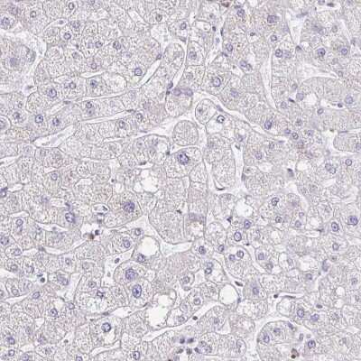 Immunohistochemistry-Paraffin: CEP170B Antibody [NBP2-31739]