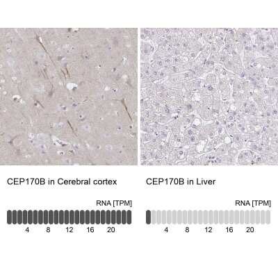 Immunohistochemistry-Paraffin: CEP170B Antibody [NBP2-31739]