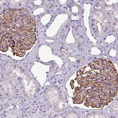 Immunohistochemistry-Paraffin: AREL1 Antibody [NBP2-14152]