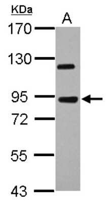 Western Blot: AREL1 Antibody [NBP2-17045]