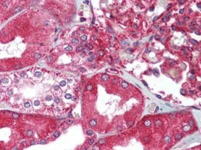 Immunohistochemistry-Paraffin: KIAA0319 Antibody [NB100-93472]