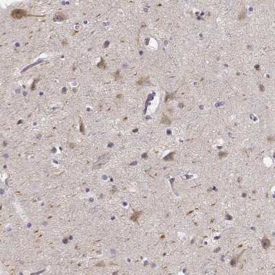 Immunohistochemistry-Paraffin: KIAA0319 Antibody [NBP1-86455]