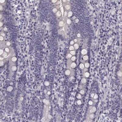 Immunohistochemistry-Paraffin: KIAA0319 Antibody [NBP1-86455]