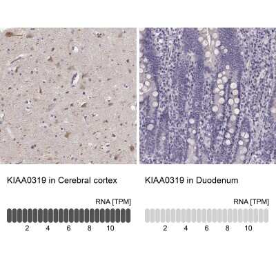 Immunohistochemistry-Paraffin: KIAA0319 Antibody [NBP1-86455]