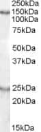 Western Blot: KIAA0319 Antibody [NB100-93472]