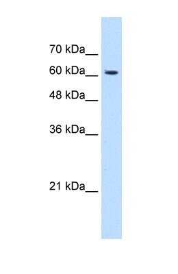 Western Blot: KIAA0319 Antibody [NBP1-59471]