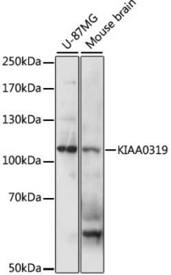 Western Blot: KIAA0319 AntibodyAzide and BSA Free [NBP3-04854]