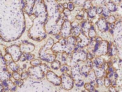 Immunohistochemistry-Paraffin: KIAA0355 Antibody [NBP3-06372]