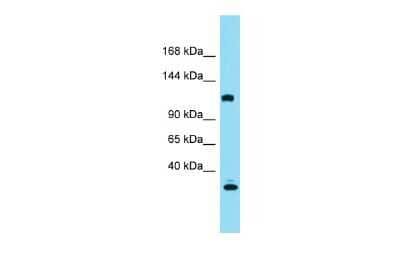 Western Blot: KIAA0355 Antibody [NBP2-83107]