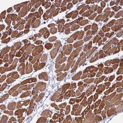 Immunohistochemistry-Paraffin: KIAA0408 Antibody [NBP1-94158]